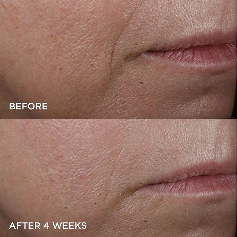 Cold Plasma Plus+ Advanced Hydrating Complex