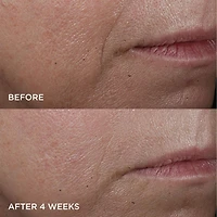 Cold Plasma Plus+ Advanced Hydrating Complex