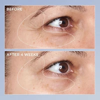 High Potency Triple Retinol Renewal Eye Serum