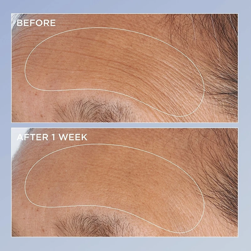 High Potency Triple Retinol Renewal Serum