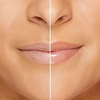 Lip Injection Maximum Plump