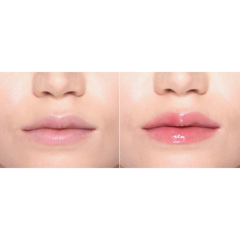 Repulpeur Lip Injection Extreme