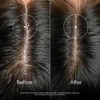 Concentrated Scalp Serum with Galangal - Anti-Loose Dandruff - High tolerance formula - 100 ml