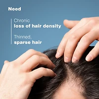 ANAPHASE Densifying Shampoo - Thin-looking hair