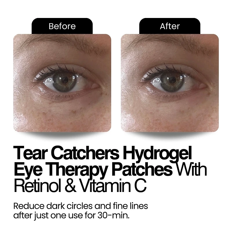 Tear Catchers Hydrogel Wrinkle & Stress-Relief Forehead & Eye Therapy Kit with Retinol & Vitamin C (x2 sets)