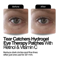 Tear Catchers Hydrogel Wrinkle & Stress-Relief Forehead & Eye Therapy Kit with Retinol & Vitamin C (x2 sets)