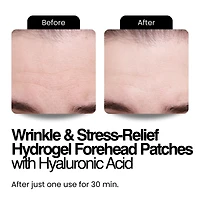Pink Perspective Hydrogel Wrinkle & Stress-Relief Forehead & Eye Therapy Kit with Hyaluronic Acid (x2 sets)