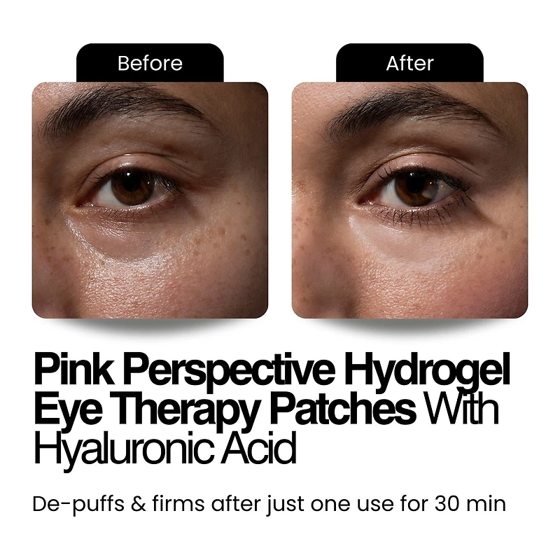 Pink Perspective Hydrogel Wrinkle & Stress-Relief Forehead & Eye Therapy Kit with Hyaluronic Acid (x2 sets)