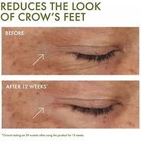 Plantscription™ Wrinkle Correction Eye Cream with Encapsulated retinol