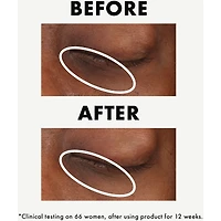 Ginzing™ Vitamin C Eye Cream To Brighten And Depuff
