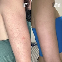 RE-START Resurfacing Body Serum