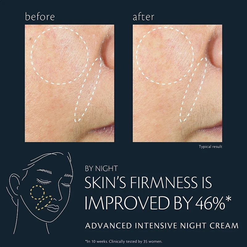Advanced Intensive Night Cream