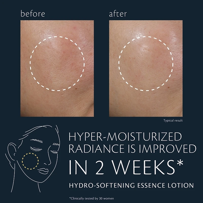 Lotion Essentielle Hydro-Adoucissante​