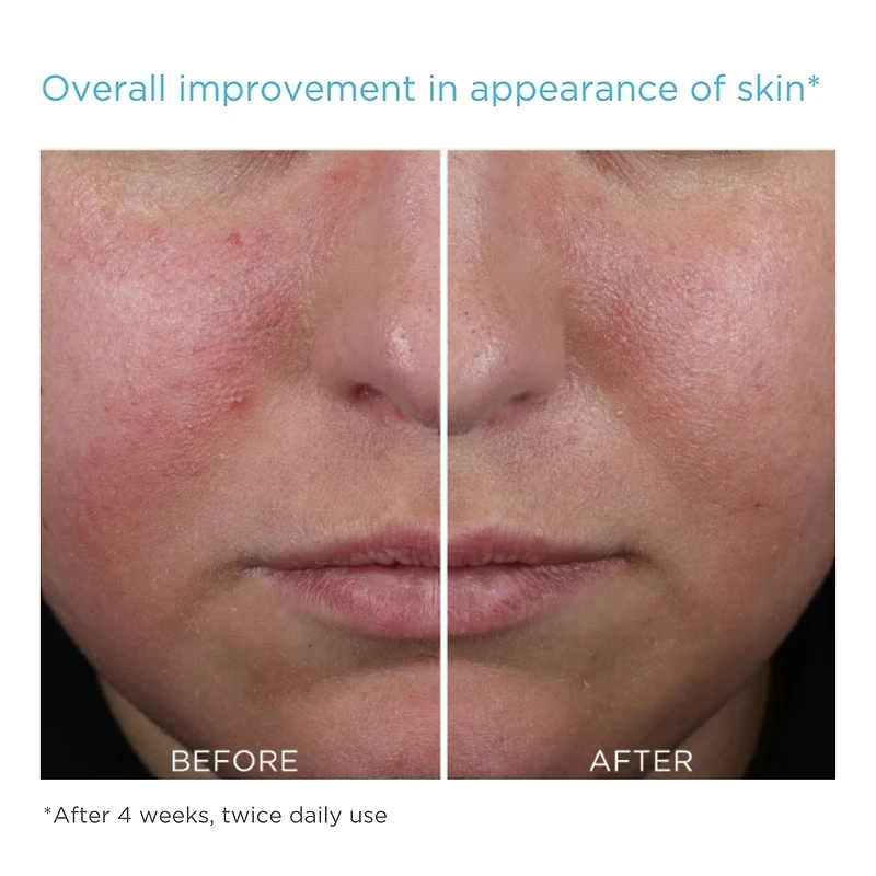 Mandelic Clarifying Hydragel