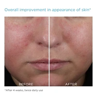 Mandelic Clarifying Hydragel