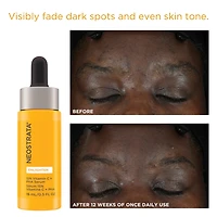 Une Peau Radieuse et Lumineuse