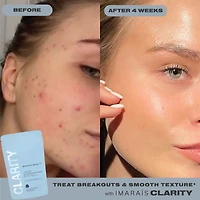 CLARITY Anti-Blemish Gummies for Clear Complexion