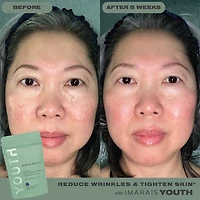 YOUTH pour réduire le vieillissement