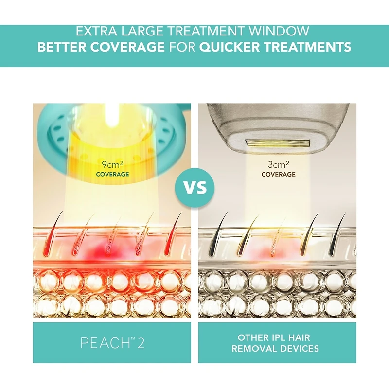 PEACH™ 2 Mint Dispositif Avancé D'épilation à la Lumière Pulsée