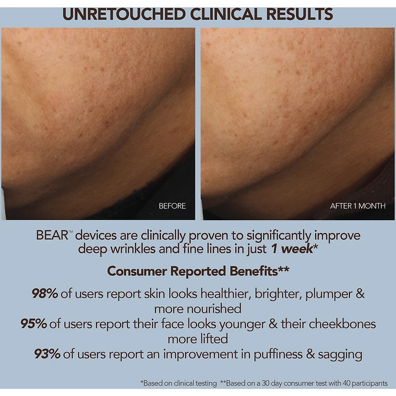 BEAR 2 Fuchsia Advanced Microcurrent Facial Toning Device