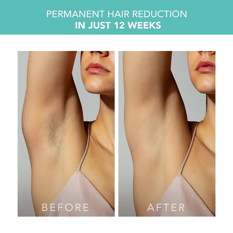 PEACH 2 Mint & PEACH Cooling Prep Gel Bundle