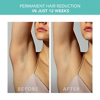 PEACH 2 Mint & PEACH Cooling Prep Gel Bundle