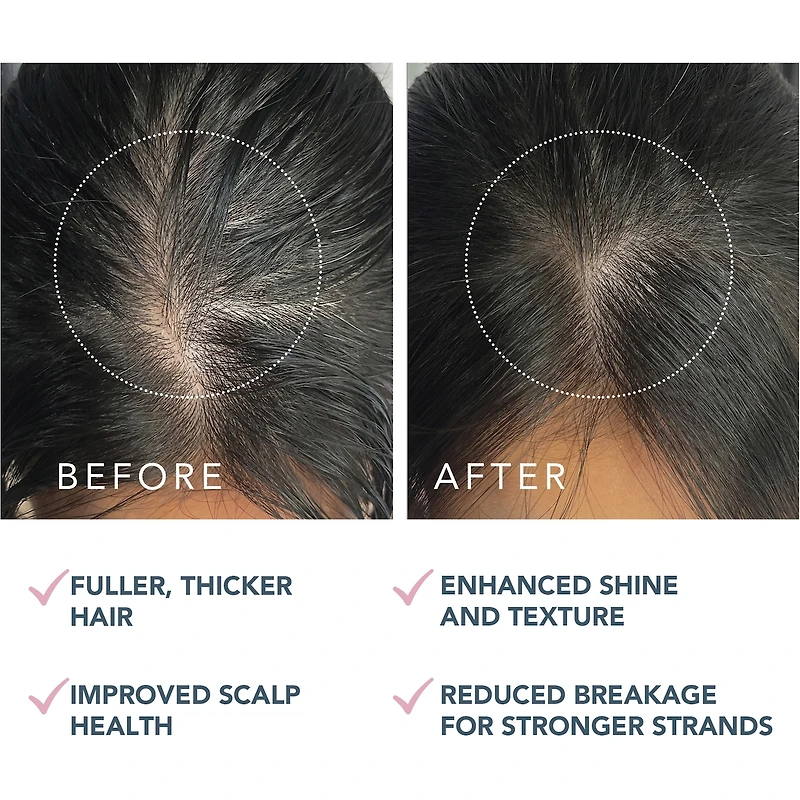LUNA Sérum Double Peptide Pour Cuir Chevelu