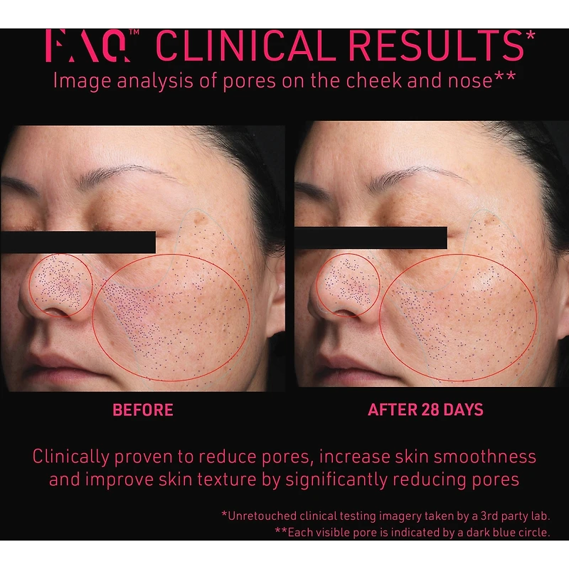 FAQ™ 102 Professional Radiofrequency