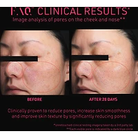 FAQ™ 102 Professional Radiofrequency