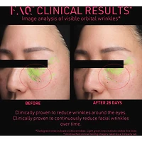 FAQ™ 102 Professional Radiofrequency