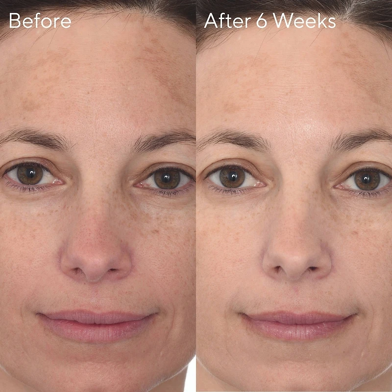 Rapid Dark Spot Correcting Serum