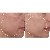 Cellular Hydration Barrier Repair Cream