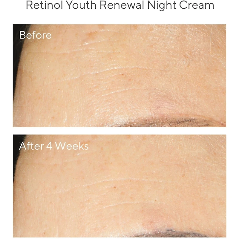 Resurgence - Crème de nuit rajeunissante au rétinol
