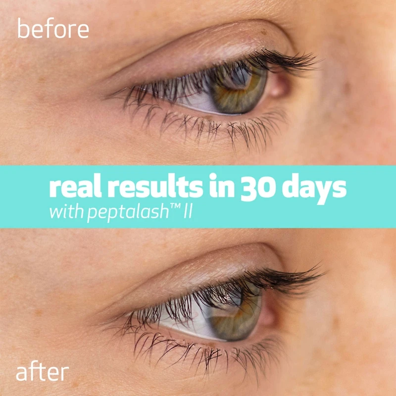 peptalash™ II - eyelash enhancing serum