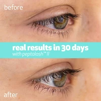 peptalash™ II - eyelash enhancing serum