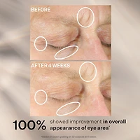 Soin Concentre Intense Pour Les Yeux Anti-rides Plus
