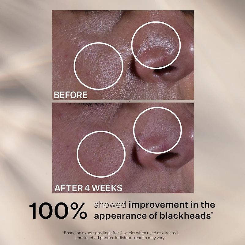 Multi-Action Super Shrink Pore Minimizing Serum