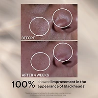 Multi-Action Super Shrink Pore Minimizing Serum