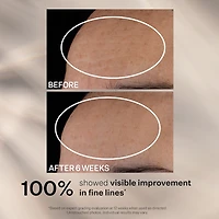 Advanced Retinol Nightly Multi-Correct Serum