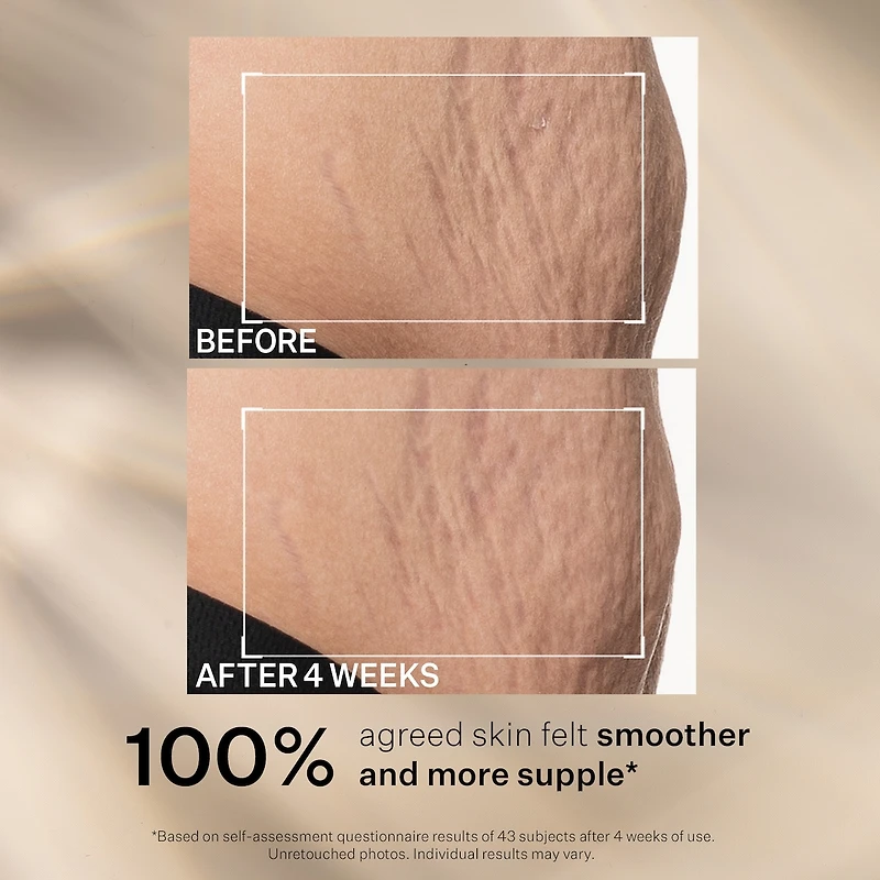 Sd Advanced™ Plus Intensive Moisturizer 2oz