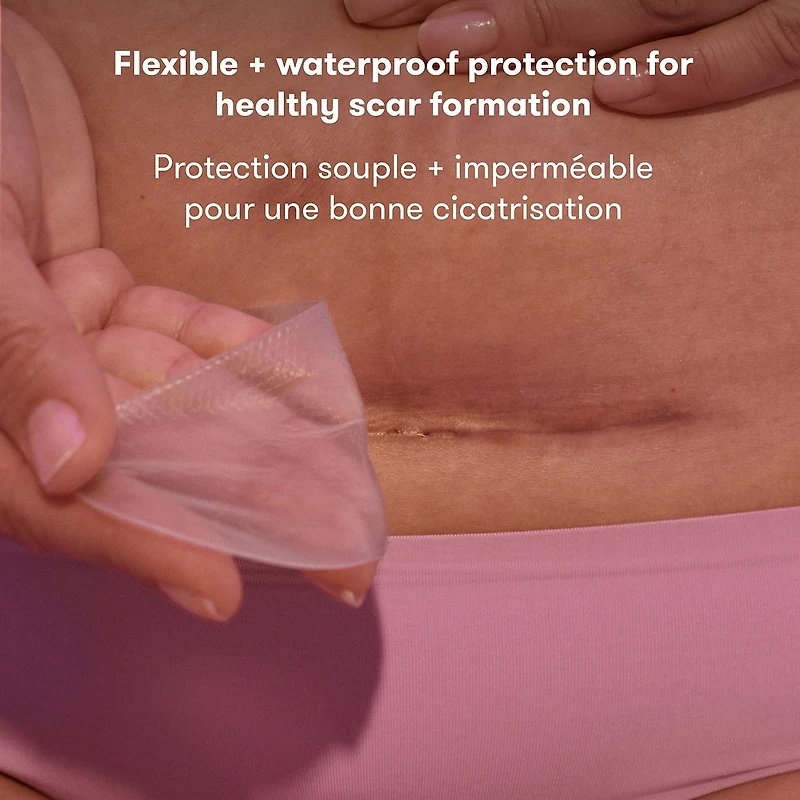 Patchs Cicatrice En Silicone Post-césarienne (Lot De 6)