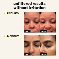 beginner retinol gel