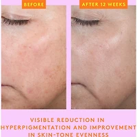 C-Firma™ Fresh Day Serum