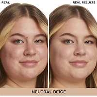 Bye Redness™ Correcting Cream & Foundation