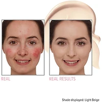 Bye Redness™ Correcting Cream & Foundation