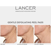 Tampon Exfoliant Doux avec 7% d'Acide Lactique et Bakuchiol