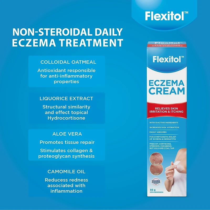 Eczema Cream
