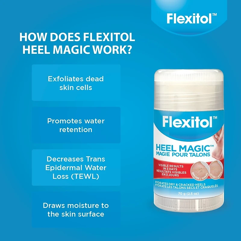 Heel Magic 70 g