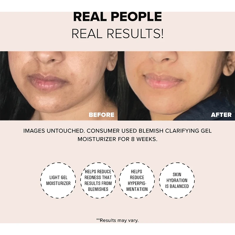 Gel Hydratant Clarifiant Imperfections