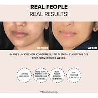 Gel Hydratant Clarifiant Imperfections